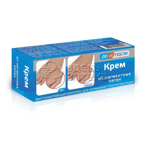 Крем До и После от пигментных пятен 50мл #1