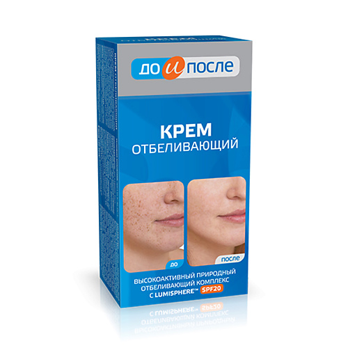 ДО И ПОСЛЕ Крем Отбеливающий 100 #1