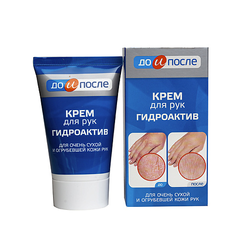 ДО И ПОСЛЕ Крем для сухой кожи рук Гидроактив 100 #1