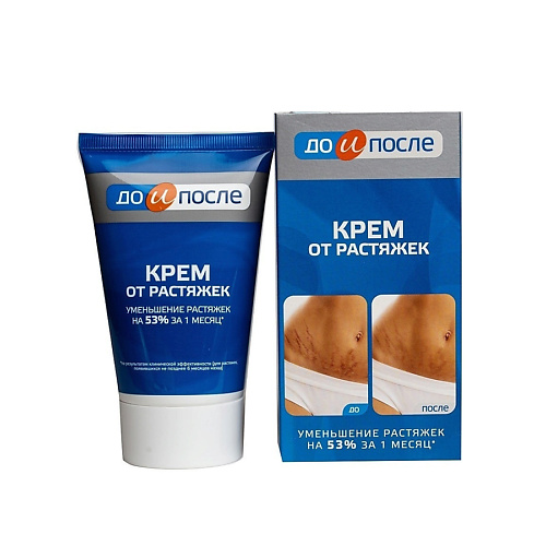 ДО И ПОСЛЕ Крем от растяжек 100 #1