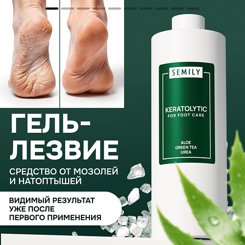 SEMILY Кератолитик для отшелушивания пяток 400 #1
